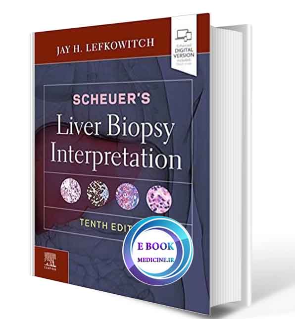 دانلود کتاب Scheuer's Liver Biopsy Interpretation2021 (PDF)