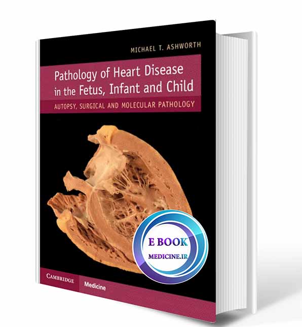 دانلود کتاب Pathology of Heart Disease in the Fetus, Infant and Child: Autopsy, Surgical and Molecular Pathology 2019