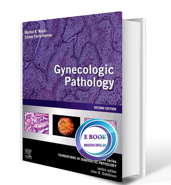 دانلود کتاب Gynecologic Pathology: A Volume in Foundations in Diagnostic Pathology Series 2nd Edition 2021