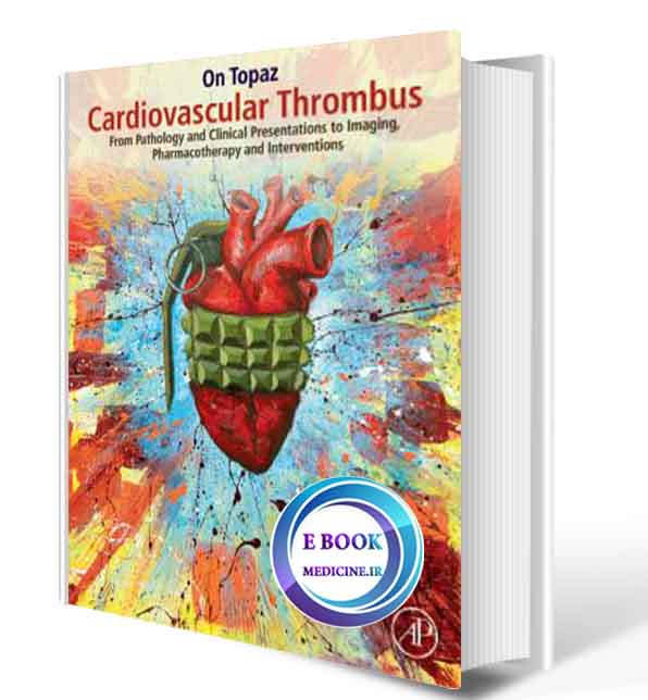 دانلود کتاب Cardiovascular Thrombus: From Pathology and Clinical Presentations to Imaging, Pharmacotherapy and Interventions 1st2019(ORIGINAL PDF)