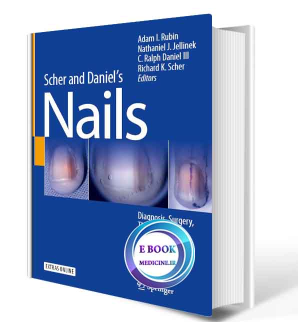 دانلود کتاب Scher and Daniel's Nails: Diagnosis, Surgery, Therapy2018 (ORIGINAL PDF)