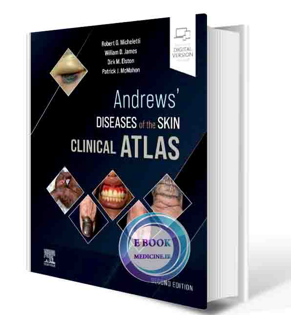 دانلود کتاب Andrews' Diseases of the Skin Clinical Atlas 2nd Edition 2023 (ORIGINAL PDF)