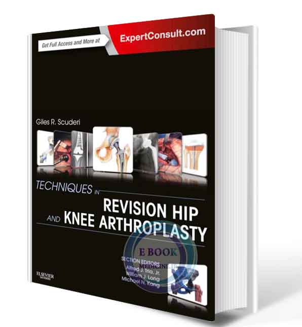 دانلود کتابTechniques in Revision Hip and Knee Arthroplasty 1st (PDF)