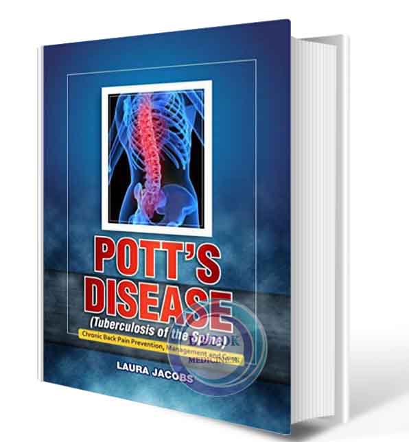 دانلود کتاب Pott's Disease (Tuberculosis of the Spine): Chronic Back pain Prevention, Management And Cure2017 ( PDF)