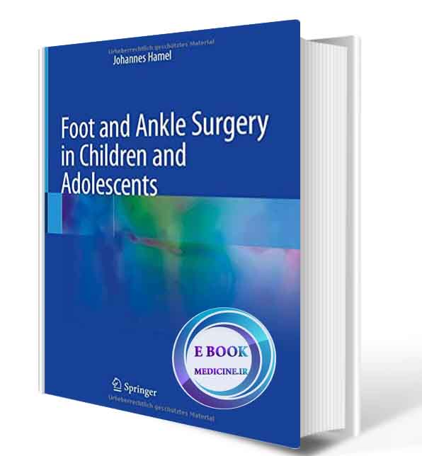 دانلود کتابFoot and Ankle Surgery in Children and Adolescents 1st ed. 2021  (ORIGINAL PDF)