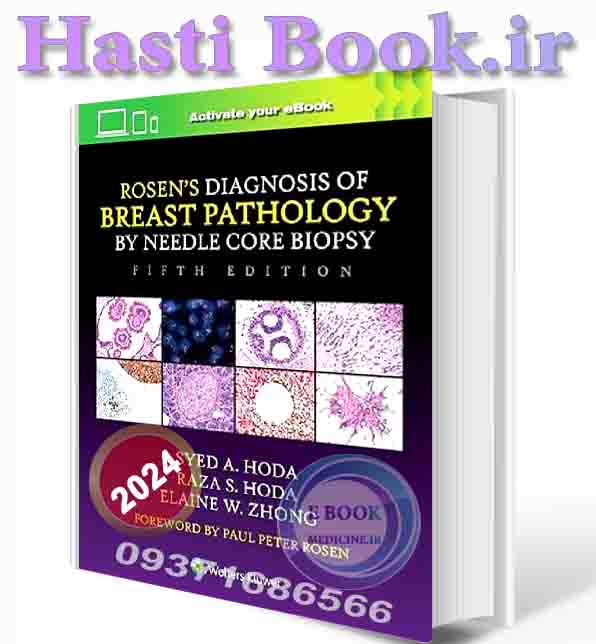 دانلود کتاب Rosen's Diagnosis of Breast Pathology by Needle Core Biopsy Fifth Edition2024 (epub+PDF) (2)