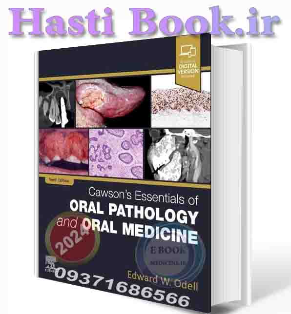 دانلود کتاب Cawson's Essentials of Oral Pathology and Oral Medicine 2024 (ORIGINAL PDF)