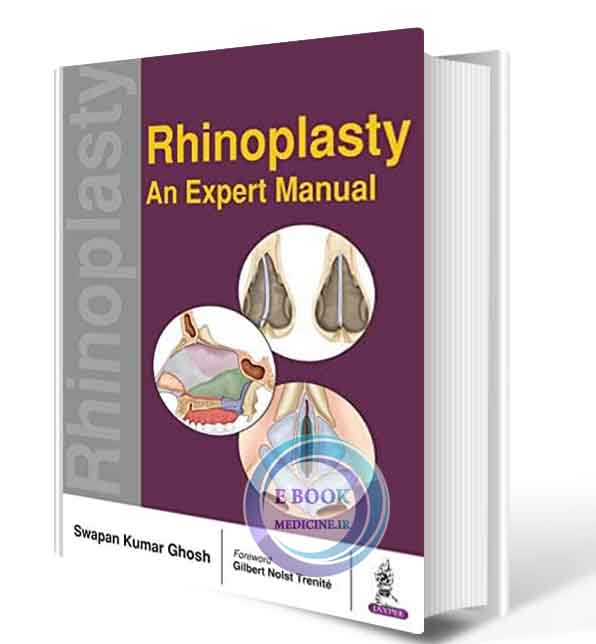 دانلود کتاب Rhinoplasty—An Expert Manual   2018 (ORIGINAL PDF)