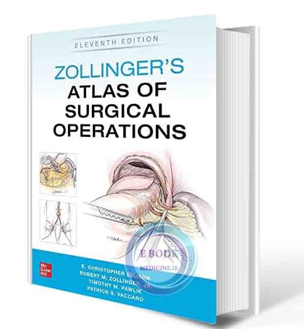 دانلود کتاب Zollinger's Atlas of Surgical Operations, 11th 2021 (ORIGINAL PDF)